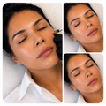Formation | Pack Toxine Botulique + Full Face